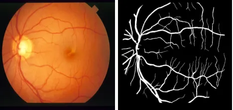 Fig 8 Retinal images from STARE database (left), hand labeled ground truth vessel segmentation    