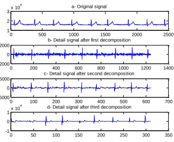 Fig 12. Third level decomposition using db8 in record f1y04 of Fantasia database. 