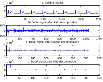 Fig 18. Third level decomposition using Coif2 in record f1y04 of Fantasia database. 