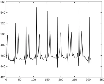 Fig 24. Matched wavelet to Old    subject f1o06 