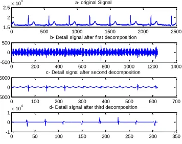 Fig 28. Third level decomposition using db6  in record f1o06 of Fantasia database. 