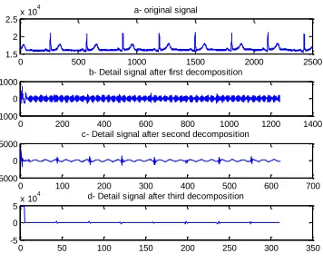 Fig 30. Third level decomposition using db8 in record f1o06 of Fantasia database. 