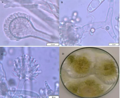 Figure 1.  (Mo); Bars, 10 µm; Aspergillus flavus, A, B: Biserriate phialide (Bi); Conidiophore (Co) and hypha (Hy); C: Monoserriate phalide D: Fungus growth on Czapek's dextrose agar medium