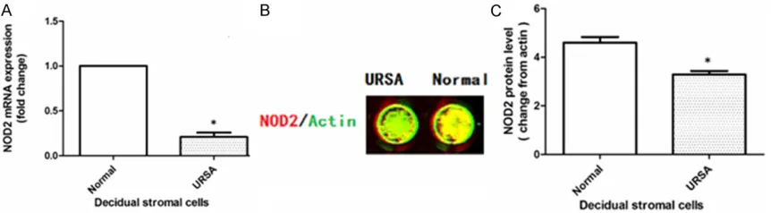 Figure 3. NOD2 expression in DSC primary culture was confirmed by RT-PCR (A) and in-cell Western blot analysis (B and C)