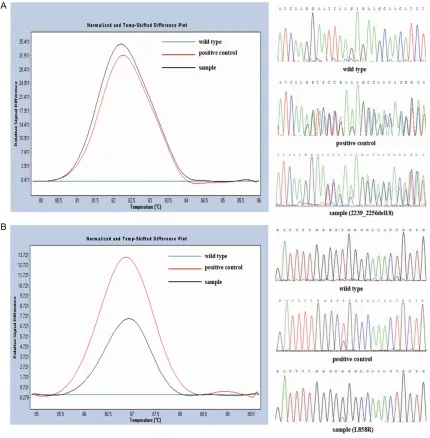 Figure 1. EGFR mutation status detected by HRM analysis and sequencing. The different plots of (A) exon 19 and (B) exon 21 show three different melting profiles corresponding to mutational samples in black, positive control in red and wild type control in 