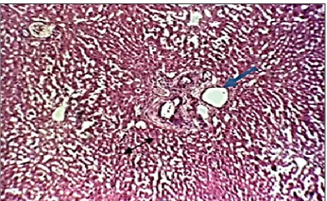 Fig. 3. Fatty changes (H&E 40x).  