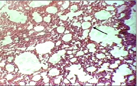 Fig. 22. Dilation alveolar space (arrow) (H&E 10x).                                          