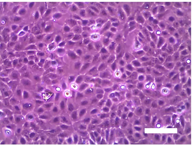 Figure 2.4: Phase contrast micrographs of HaCaT cells cultured for 3 days at 1 : 6 dilutions (Scale bar: 100 µm) 