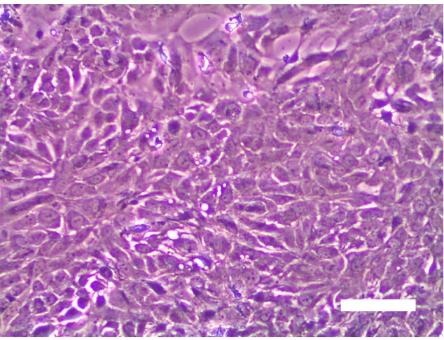 Figure 2.5: Phase contrast micrographs of ORL-48 cells cultured for 3 days at 1 : 6 dilutions (Scale bar: 100 µm) 