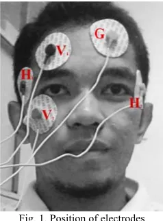 Fig. 1. Position off electrodes 