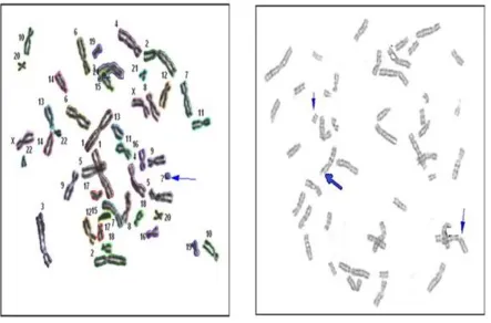 Table 2, Metformin effect on GSH(nmol/106cell),MDA(nmol/106cell) and 8-OH-dG(pg/106cell) in lymphocytes cultures   (6 samples each,Mean±SD) 
