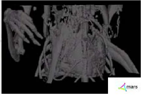 Figure 9: Cross section of a mouse abdomen with its main  components labelled (a) spine, (b) support tube, (c) stomach and (d) air