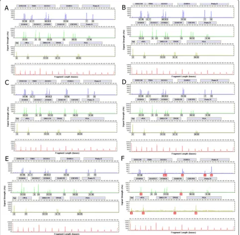 Fig. 6 Representative profiles from dried finger prick blood samplesboxesSystem reports peaks in a 25 μl, b 10 μl, c 5 μl, d 3 μl, e 1 μl, and f 0.1 μl