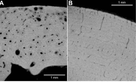 Figure 4 enlarged images of the compact bones obtained by intensely focused CT slicing.Notes: Histological structures can be seen clearly and the lamellar pattern is found in bovine specimen