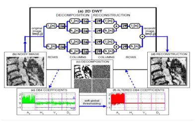 Fig 3.4 wavelet Base Image denoising 