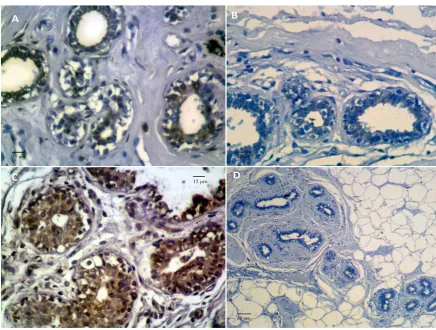 Fig 2: Bar chart showing the percentages of the staining of ER, PR, BCL2 and C-MYC in Control, Benign and malignant groups of breast tissue