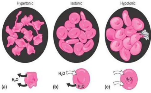 Fig 1: Showing a. Hypertonic b. Isotonic c. Hypotonic 