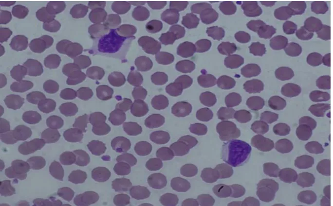 Figure 3.2: Original image of blood for 40X objective 