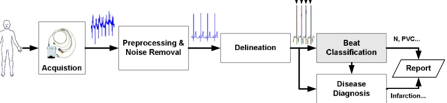 Figure 1. Architecture of a ECG based clinical decision support system.