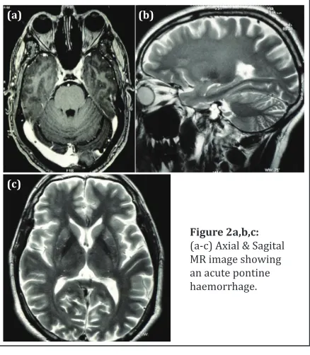 Figure 2a,b,c: