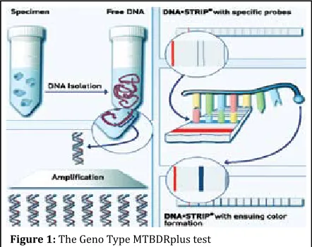 Figure 1: The Geno Type MTBDRplus test