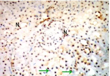 Fig. (8): A photomicrograph of kidney cortex of thyroidectomized adult male albino rat showing some positive immunoreactive nuclei (N) among the normal 