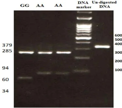 Figure 1. Genotyping of rs2274223 through digestion of PCR product with figure. The 34-bp fragment cannot be observed here because of small AciI restriction enzyme