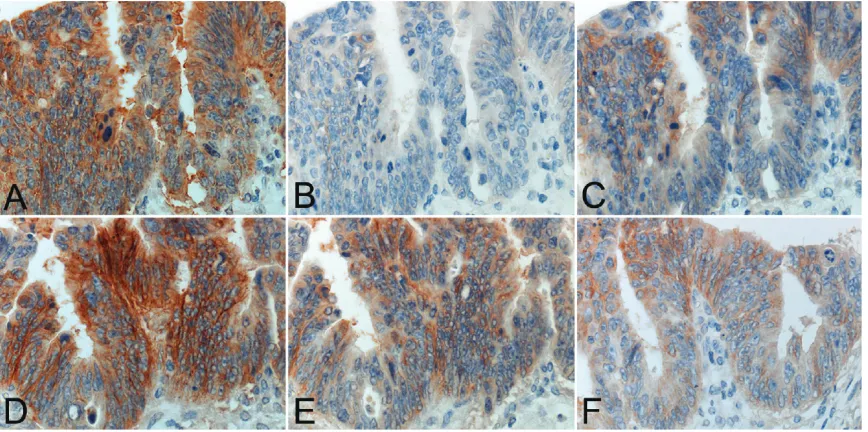 Table 1. EGFR immunostaining in various combinations