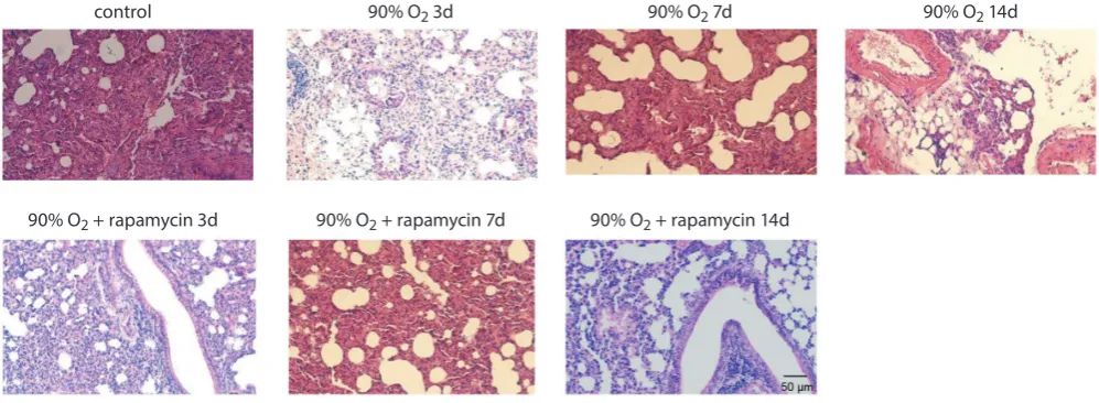 Table 2. The pathological scores of lung injury in rat model (n = 6)