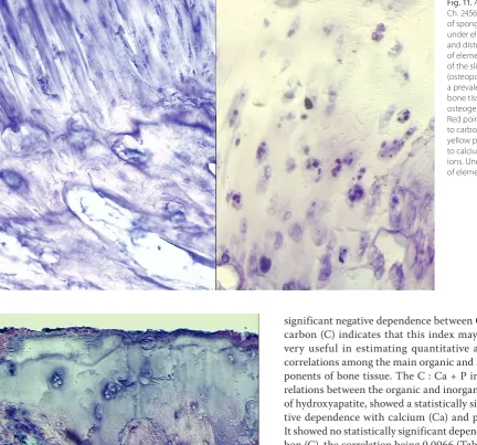 Fig. 11. AK slide (Hist. 