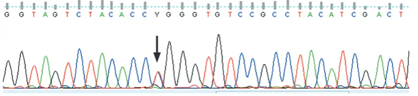 Fig. 1. Electropherogram of F strand of showing the p.Arg254Trp mutation in exon 7 of the CTRC gene