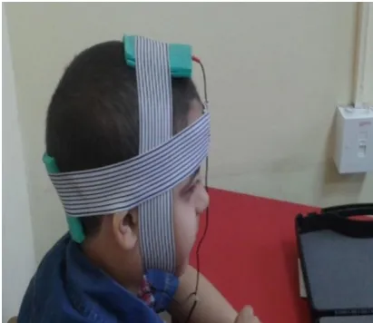 Figure 2: Electrodes position of tDCS 