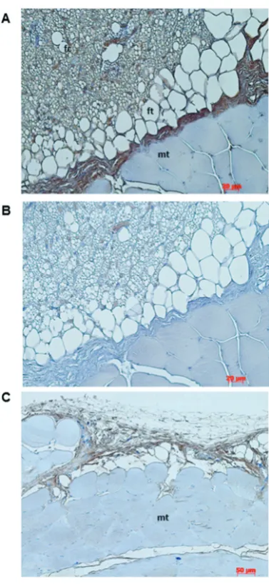 Fig. 4. Detection of CD68 antibody in muscle tissue cross-section embedded in paraffin from (A+B) oxidized cellulose-treated rats and C – untreated rats; B – control staining with phosphate-buffered saline (PBS) instead of the primary antibody