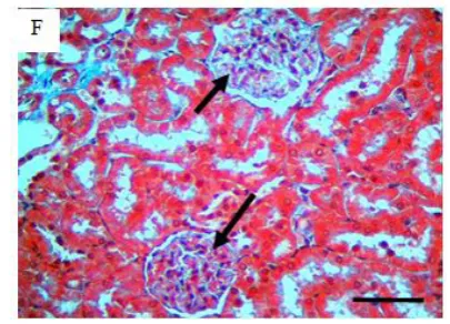 Figure 5: stained sections of renal cortex detecting proteoglycan content in glomeruli