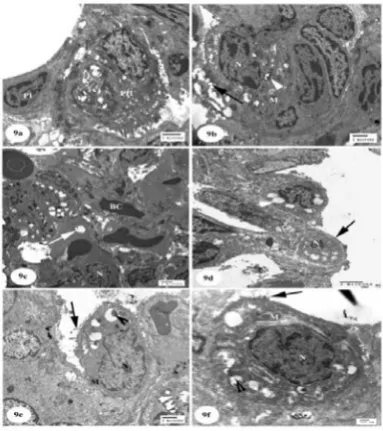 Figure 7: of collagen fibers in pulmonary interstitium around alveolar sacs distribution of collagen fibers in pulmonary interstitium  around normal structure of collagen fibers in interalveolar septa around Photomicrographs of lung sections (a): control group showing normal distribution of collagen fibers in pulmonary interstitium around bronchiole (B) (Masson's trichrome; Scale bar  = 100 µm), (b): grape seed group showing normal alveoli (A) (Masson's trichrome; Scale bar = 200 µm), (c): Ginkgo biloba group (Masson's trichrome; Scale bar = 200 µm), (d): Amiodarone-treated group showing deposition (A) and in interalveolar septum and severe deposition of collagen fibers around bronchiol (arrow) (Masson's trichrome; Scale bar = 100 µm), (e): Amiodarone-treated group showing severe deposition of collagen fibers around the blood vessels (arrow) (Masson's trichrome; Scale bar = 100 µm), (f): Amiodarone group treated with grape seed showing nearly alveoli (A) and the wall of bronchiol (B) (Masson's trichrome; 