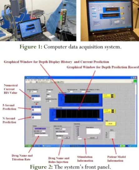Figure 1: Computer data acquisition system. 