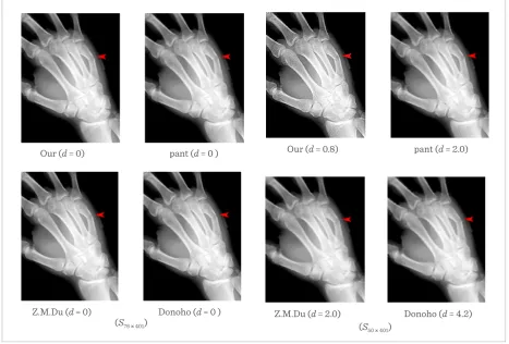 Figure 6.Figure 6. X X-coordinates of the CT image-coordinates of the CT image and its new expression  and its new expression under the new bases under the new bases 