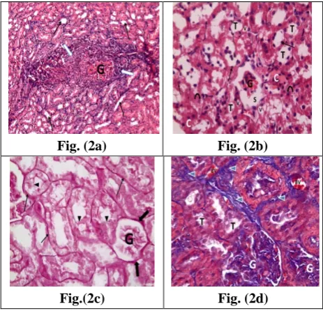 Fig. (2a) 