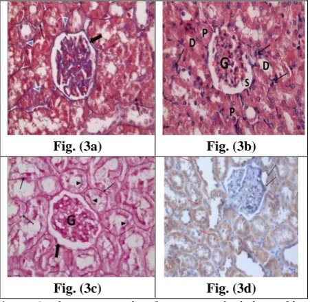 Fig. (3a) 