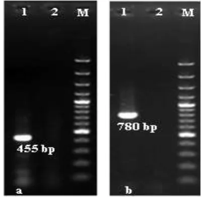Figure 1.  Molecular identification of tick species by PCR amplification of DNA markers detected in 1.5% agarose gels stained with ethidium bromide