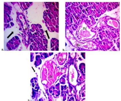Figure 2: section of a rat pancreas from group III showing loss of architecture of pancreatic acini (A), congested blood vessels (BV), dilated duct (D) and wide spaces between acini (black (BV) and loss of architecture of acini (A) c