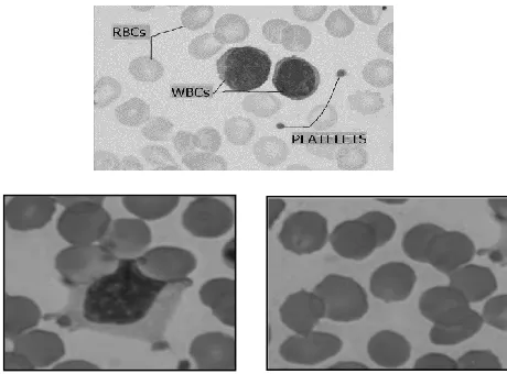 Figure 1 and 2 shows the image of the blood cell and it’s characteristic.  