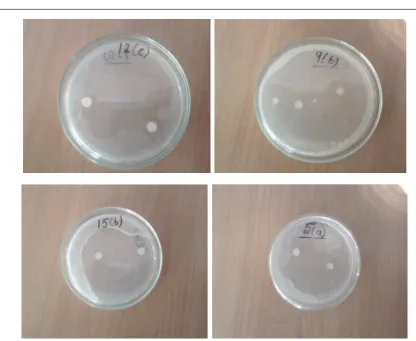Figure 2 : Some notable photographs for anti bacterial studies of compounds under study 