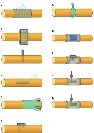 Fig. 4. Different approaches to peripheral nerve interfaces: A. Nerve cuffs; B. FINE (flat-interface nerve electrode); C