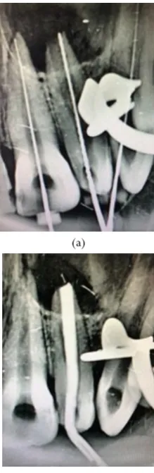 Figure 1: Pre-Operative Clinical Photograph 