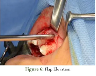 Figure 6: Flap Elevation             