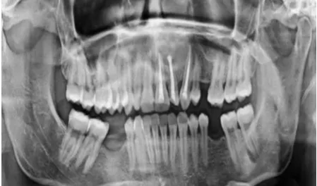 Figure 14: 1 Year Post-Operative 