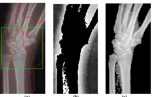 Fig 2 (a) is the evolution result of LBF after 100 times, (b) is the down parts of the image gray,  (c) is the upper parts of the image gray 