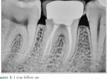 Figure 3: 1 year follow-up 