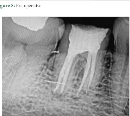 Figure 7: 6 Months follow-up 